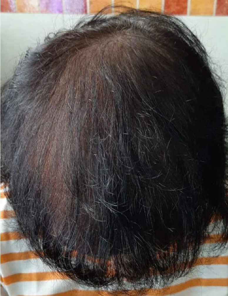 After